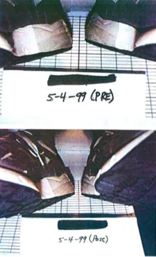 Two dental or medical specimen photographs labeled with dates 5-4-99 (PM) and 5-4-99 (AM) on graph paper with scale bar.