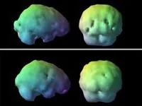 Four 3D brain models displayed from different angles, colored in green, yellow, and blue gradients