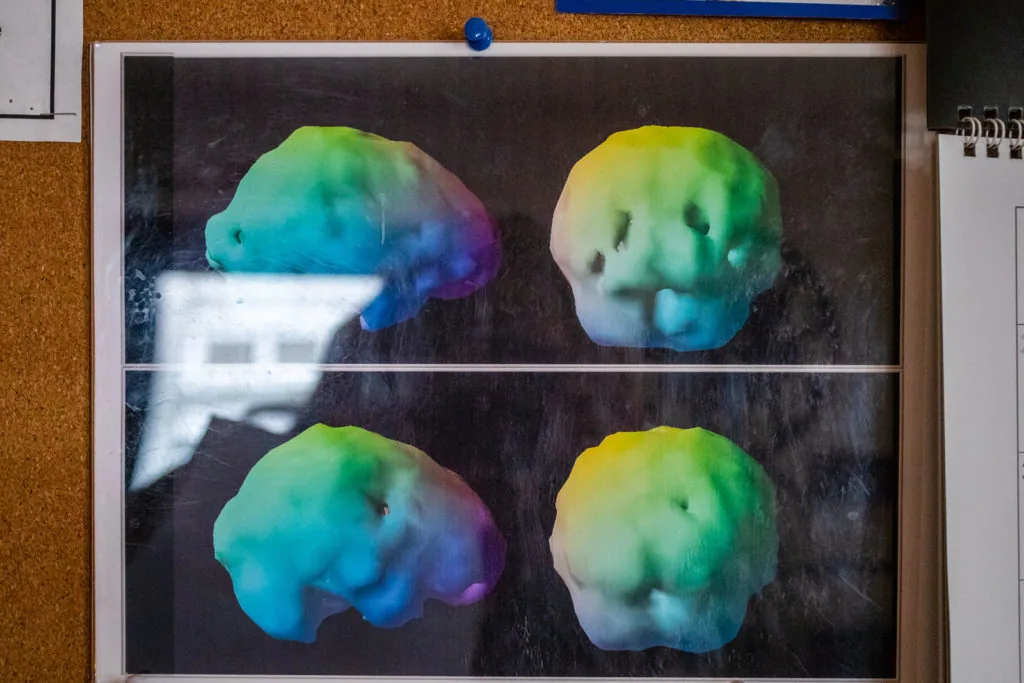 Four 3D brain scans displayed on a dark background with rainbow-colored gradient imaging showing different angles and views