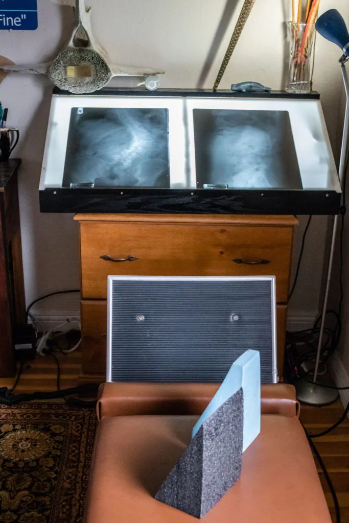 X-ray light box with two radiographic images mounted above wooden cabinet with monitor and diagnostic equipment on desk