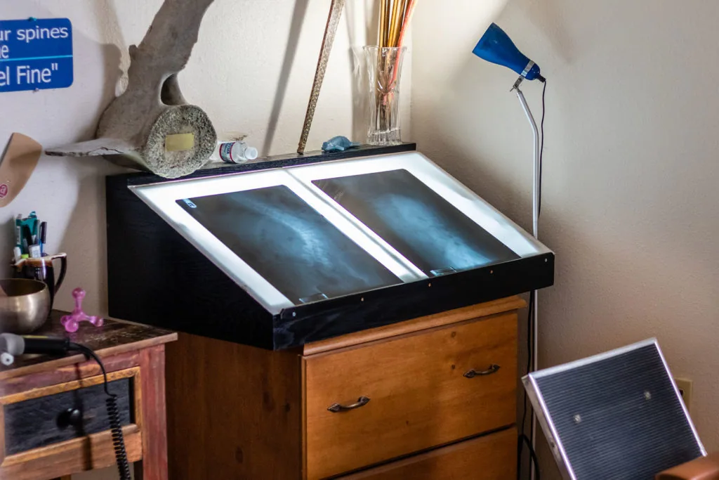 Illuminated light box display with two X-ray images mounted on wooden cabinet in chiropractic office