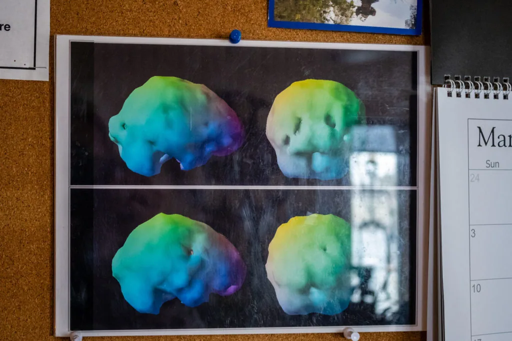 Four colorful brain scans with gradient coloring from blue to green to yellow displayed on a dark background in a white-framed poster