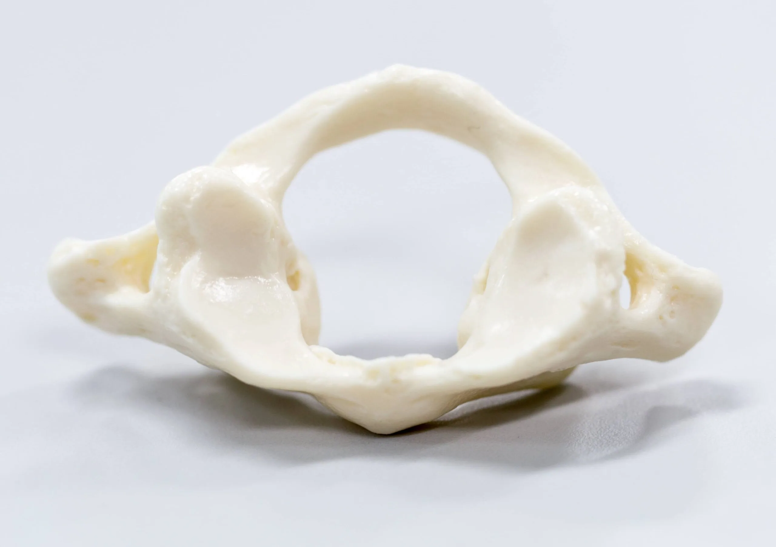 White vertebra bone specimen with central opening and articulation facets on light background